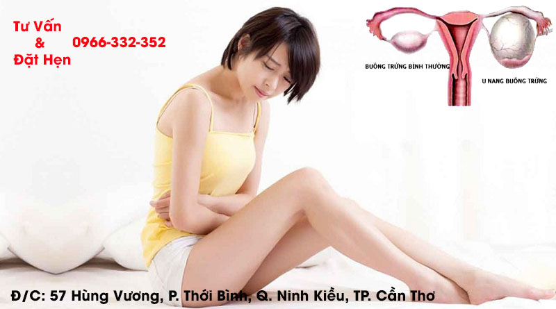 U Nang Buồng Trứng - Nguyên Nhân Và Tác Hại