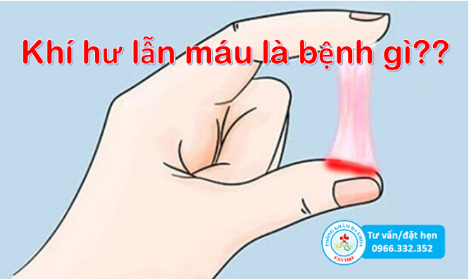Ra huyết trắng có lẫn máu là bệnh gì? | Phòng khám đa khoa Cần Thơ